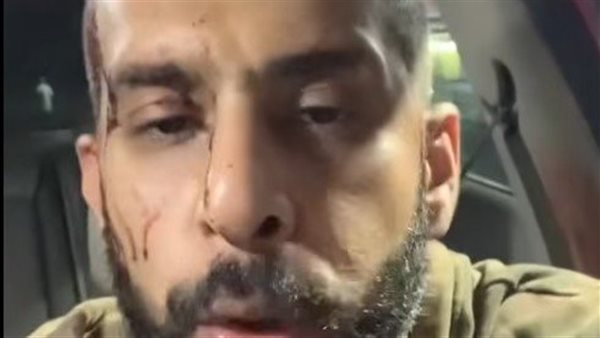 صرف سائق أوبر ضحية الاعتداء من شابين على الطريق الصحراوي بعد الإدلاء بأقواله