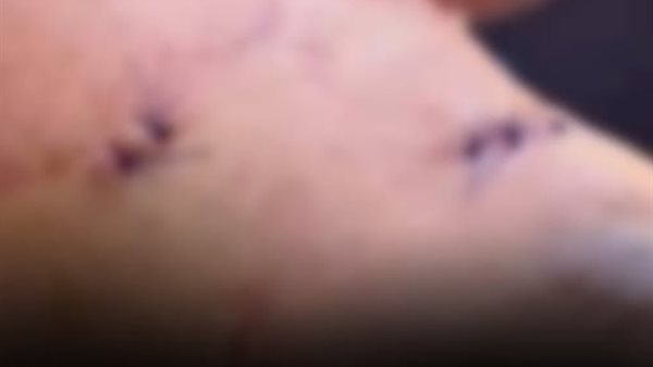 ضبط المتهمين في اعتداء على طالب ثانوية أمام مدرسته بالدقهلية