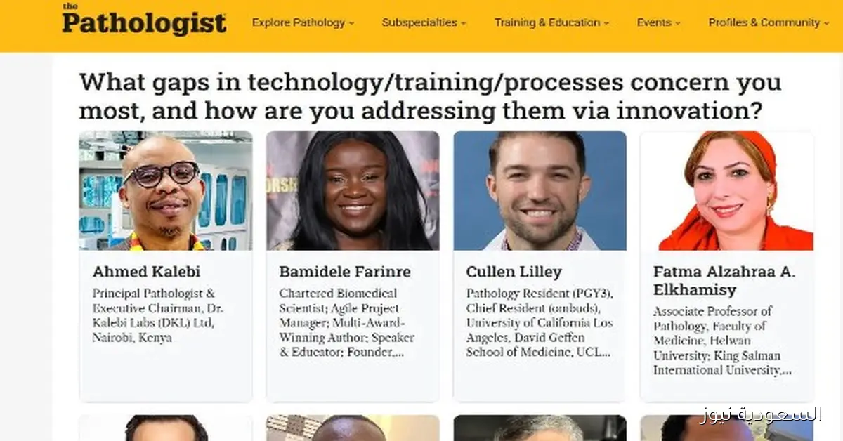 فاطمة الزهراء الخميسي تتألق للمرة الثالثة في قائمة الـ 50 ملهمًا عالميًا في الباثولوجيا