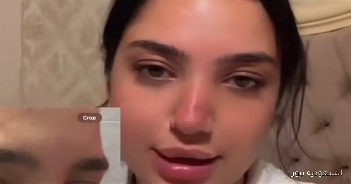 كنزي مدبولي تتحدث عن تعافيها بعد أزمة حقنة الفيلر: 95% من الشفاء ولن أتنازل عن حقي