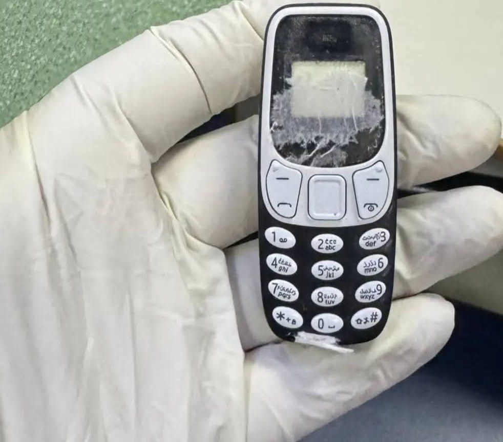 كان خارج الخدمـة.. إخراج هاتف محمول من بطن مريض بعد 11 شهرًا من ابتلاعه في جامعة المنصورة