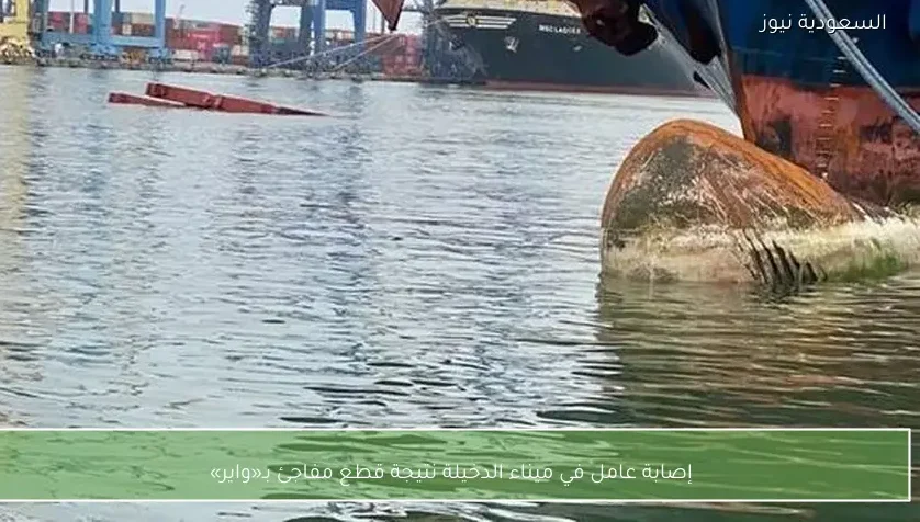 إصابة عامل في ميناء الدخيلة نتيجة قطع مفاجئ بـ«واير»