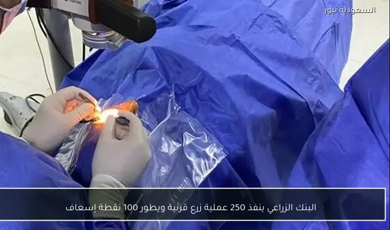 البنك الزراعي ينفذ 250 عملية زرع قرنية ويطور 100 نقطة إسعاف