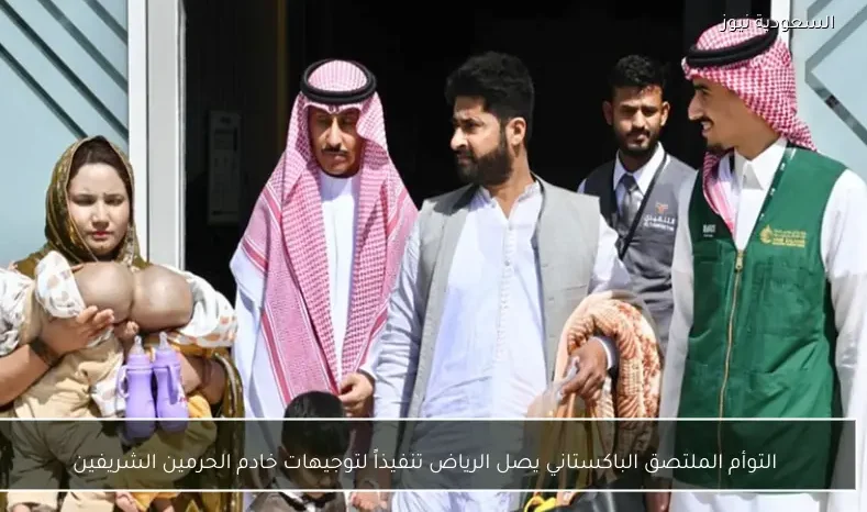 التوأم الملتصق الباكستاني يصل الرياض تنفيذاً لتوجيهات خادم الحرمين الشريفين
