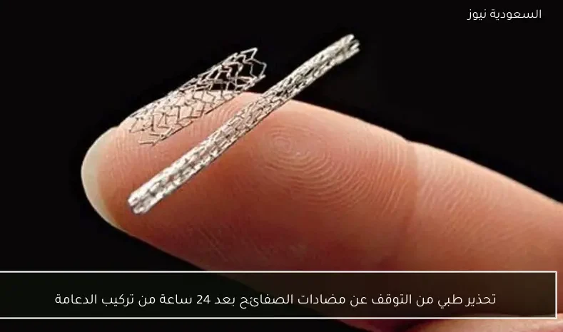 تحذير طبي من التوقف عن مضادات الصفائح بعد 24 ساعة من تركيب الدعامة