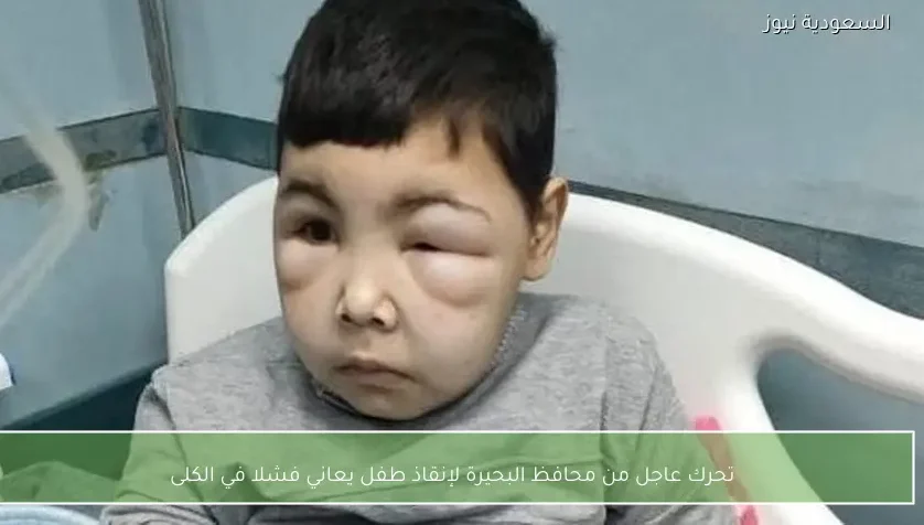 تحرك عاجل من محافظ البحيرة لإنقاذ طفل يعاني فشلا في الكلى