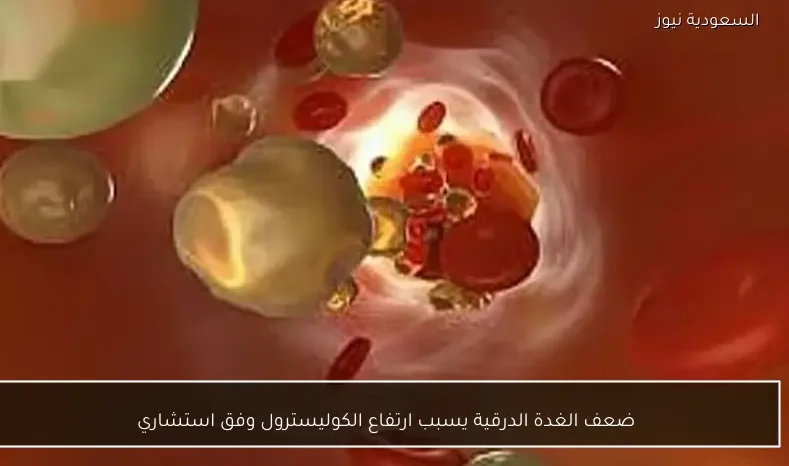 ضعف الغدة الدرقية يسبب ارتفاع الكوليسترول وفق استشاري