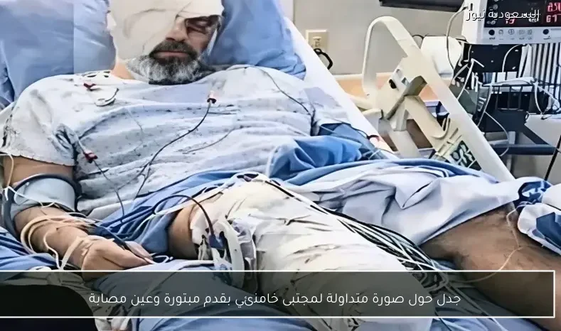 جدل حول صورة متداولة لمجتبى خامنئي بقدم مبتورة وعين مصابة